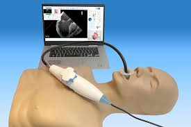 Transesophageal Echocardiography (TEE)